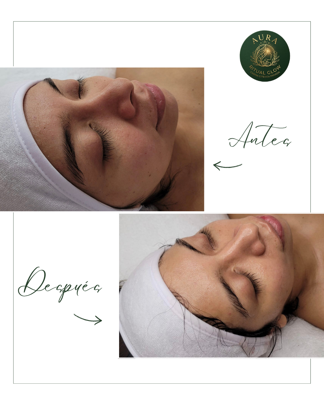 Facial Express Glow